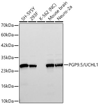 PGP9.5/UCHL1 Monoclonal Antibody [4F10B1]