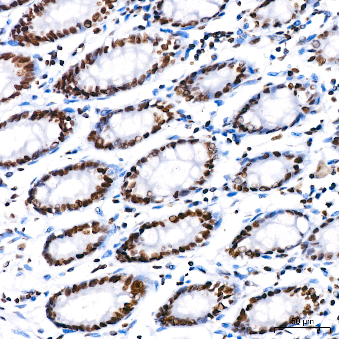 PARP1 Monoclonal Antibody [2G8N7]
