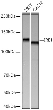 IRE1 Monoclonal Antibody [8P0L0]