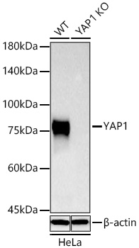 YAP1 Monoclonal Antibody [5J9N6]