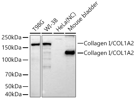 Collagen I/COL1A2 Monoclonal Antibody [9Q1C6]