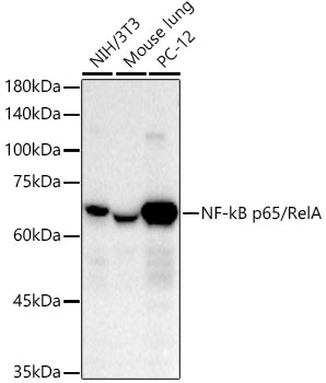 NF-kB p65/RelA Monoclonal Antibody [6D6R8]