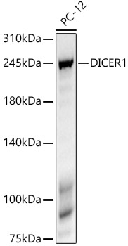 DICER1 Monoclonal Antibody [0X1M6]