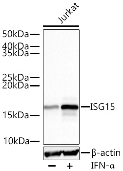 ISG15 Monoclonal Antibody [2C6V1]&nbsp;<img src="images/icon_newarrival.gif" alt="new" border="0">