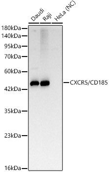 CXCR5/CD185 Monoclonal Antibody [10C8U8]