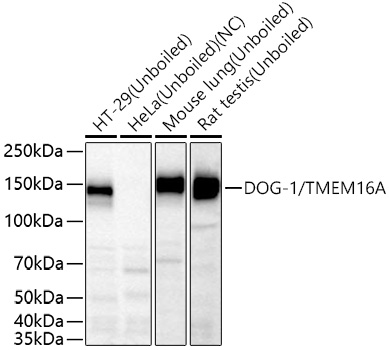 DOG-1/TMEM16A Monoclonal Antibody [9Y0O7]