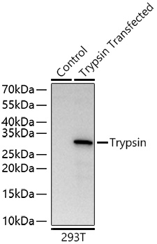 Trypsin Monoclonal Antibody [4M7L7]