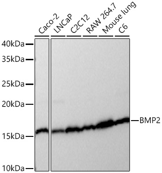 BMP2 Monoclonal Antibody [5W10C10]