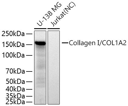 Collagen I/COL1A2 Monoclonal Antibody [1M8Z7]