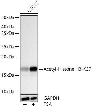 Acetyl-Histone H3-K27 Monoclonal Antibody [2V10N10]&nbsp;<img src="images/icon_newarrival.gif" alt="new" border="0">