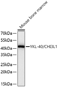 YKL-40/CHI3L1 Monoclonal Antibody [3S6K3]