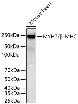 MYH7/B-MHC Monoclonal Antibody [4G3E9]