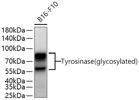 Tyrosinase Monoclonal Antibody [5V0H6]