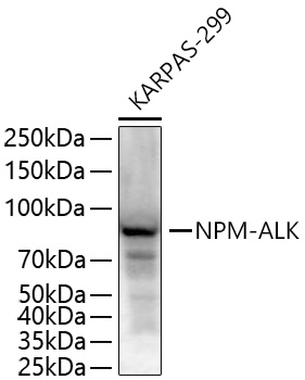 ALK Monoclonal Antibody [6F4N9]