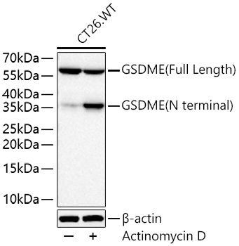 GSDME (Full Length+N terminal) Monoclonal Antibody [9B3K0]