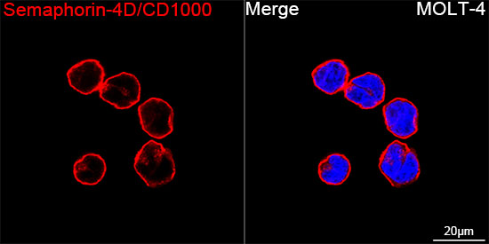 Semaphorin-4D/CD100 Monoclonal Antibody [5T5P8]