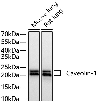 Caveolin-1 Monoclonal Antibody [8E10W3]
