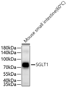 SGLT1 Monoclonal Antibody [1C5W2]