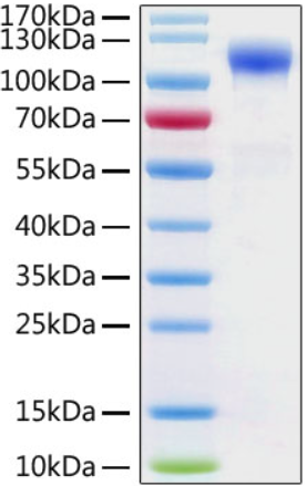 Recombinant ACE2 Protein with His-Tag (100 µg)