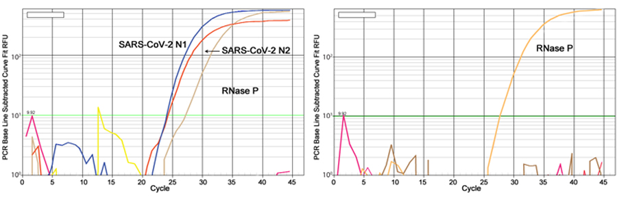 EpiQuik Viral RNA Extraction Fast Kit