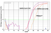 EpiQuik Viral RNA Extraction Fast Kit