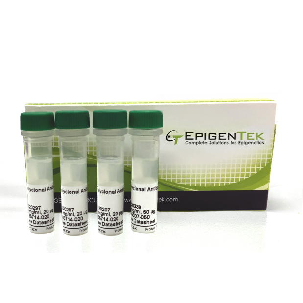 Histone H3 Methylation Antibody Panel Pack II - Active Genes (3 x 25 µl)