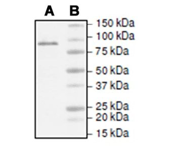TET1 Protein (Active) (10 µg)