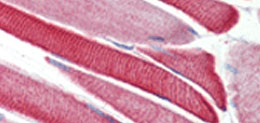 Metabolism Knockout (KO) Antibodies